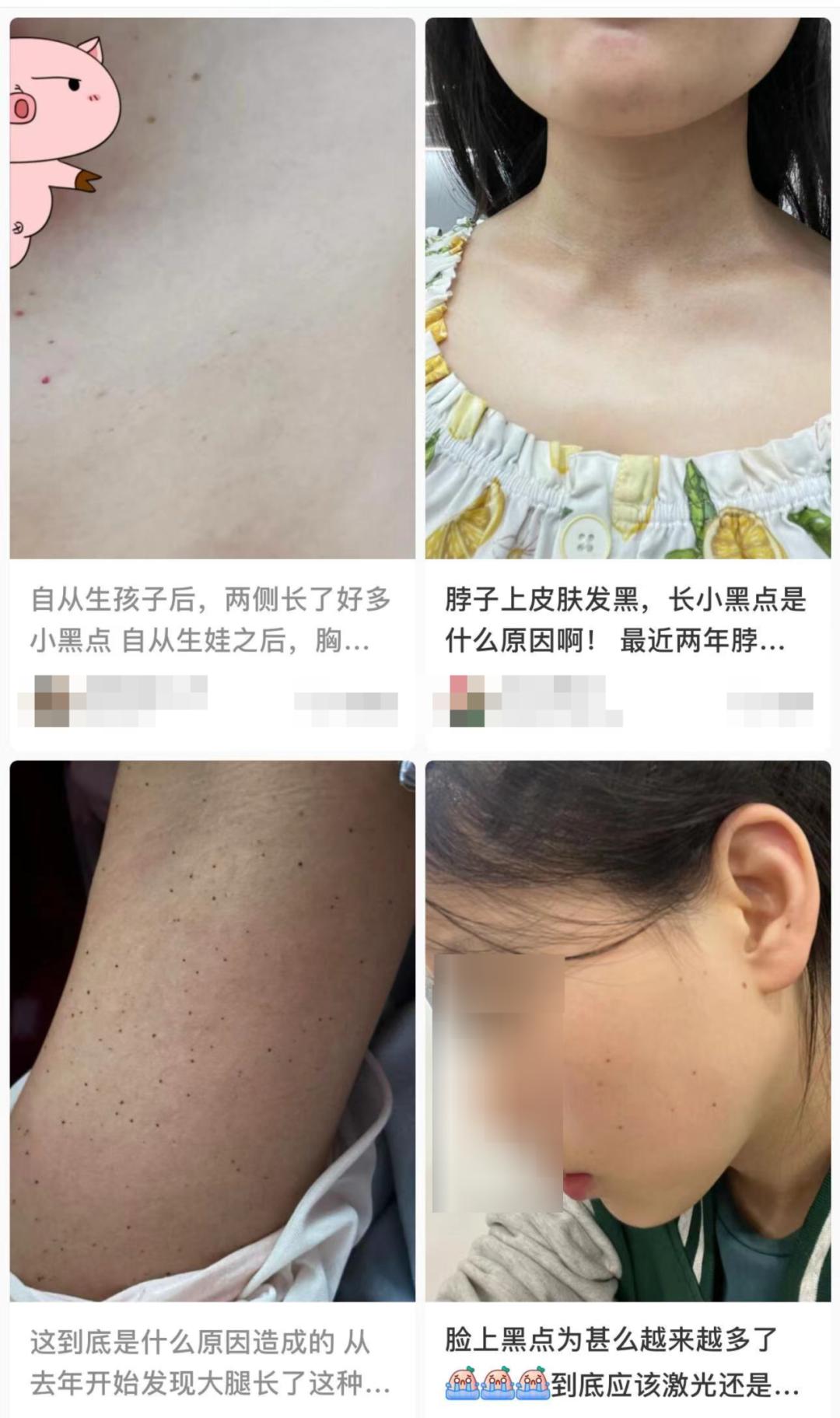 皮肤上莫名其妙冒出的小黑点是啥，上网一搜说什么的都有，真的有